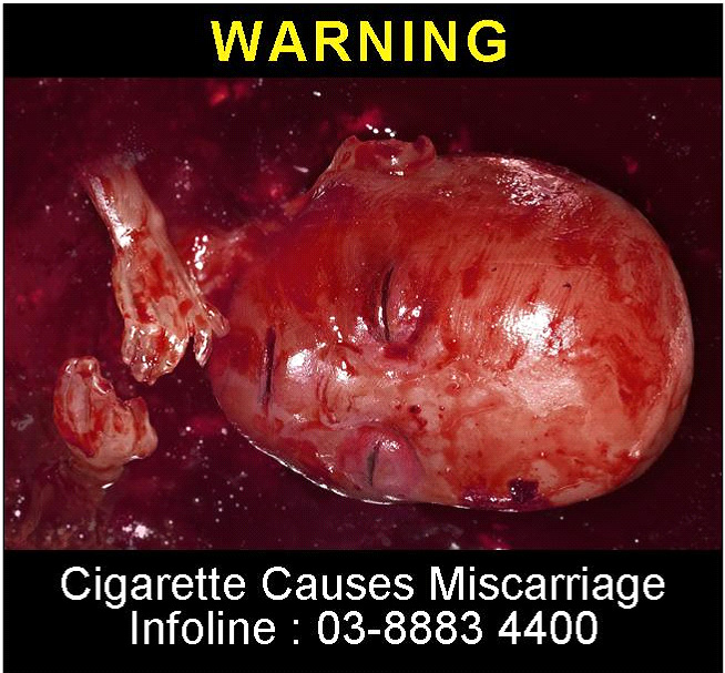 Malaysia 2008 ETS Baby - miscarriage, graphic (back)
